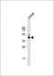 LCK Antibody